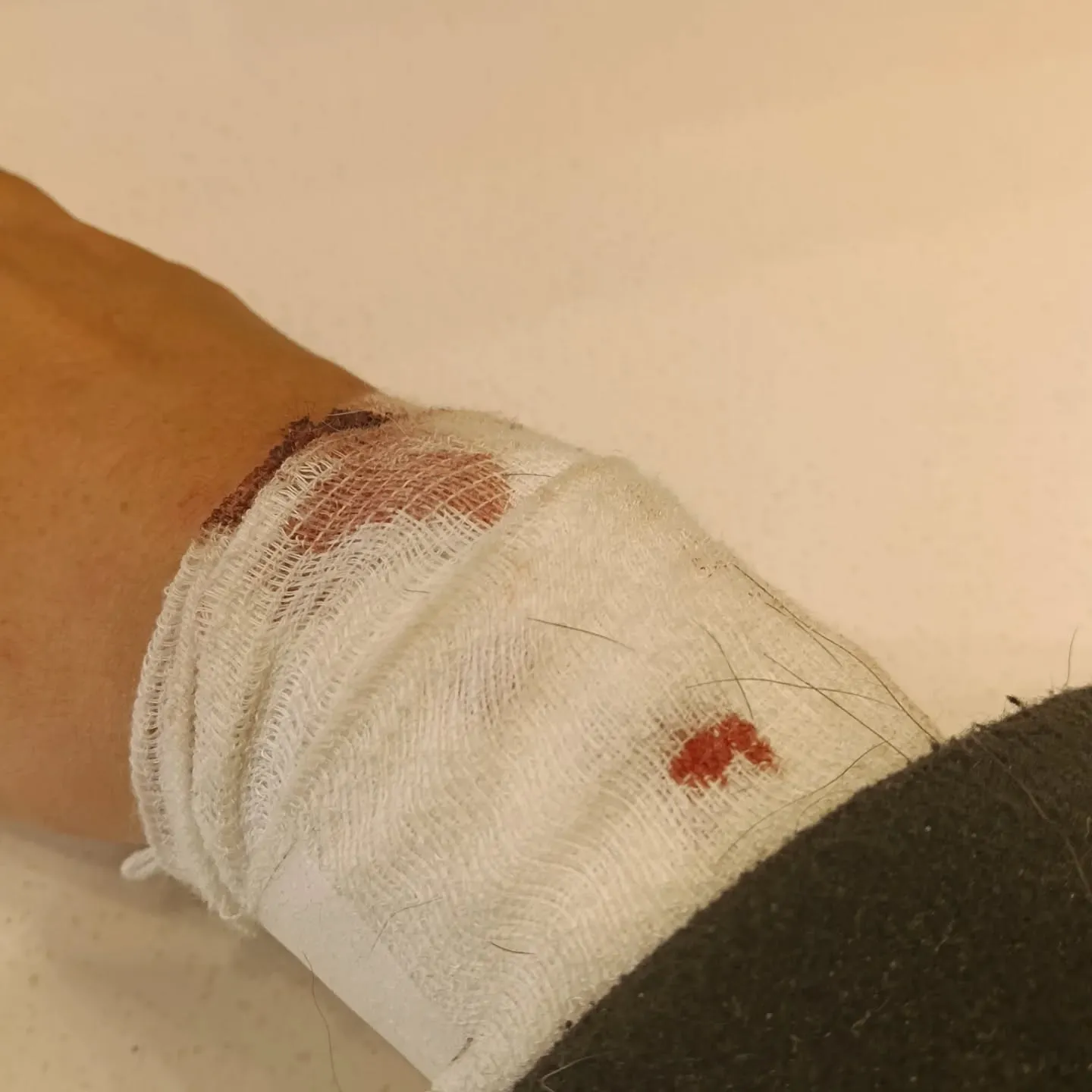 ショッキングな画像が含まれます！！